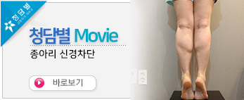종아리신경차…