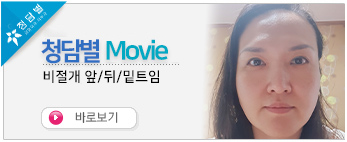 비절개 앞트임 …