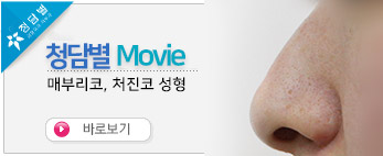 매부리코,처진…