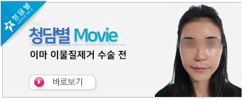 이마 이물질제…