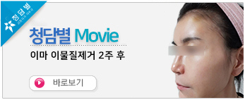 이마 이물질제…