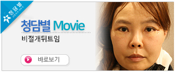비절개뒤트임 …
