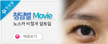 비절개노스카…
