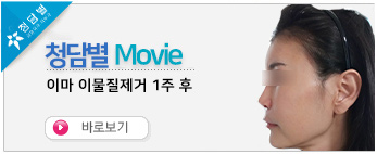이마 이물질제…