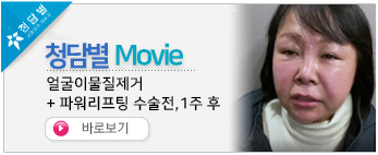 얼굴이물질제…