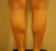 2013/02/18 종아리…