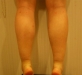 2013/02/18 종아리…