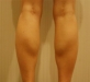 2013/01/09 종아리…
