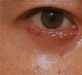 2013/04/03 눈밑지…