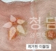 볼이물질제거