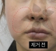 팔자이물질제…