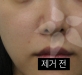 코실제거
