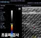 종아리 신경차…