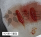 턱이물질제거