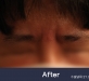 미간주름신경…