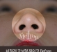 비절개코성형 …