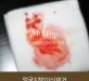[이물질제거] 18…
