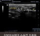 지방이식제거 …