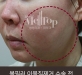 볼필러 이물질…