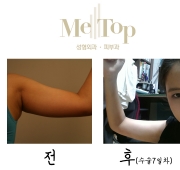 쵸콜렛 테라피 …