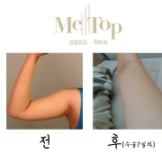 초콜렛테라피 1…