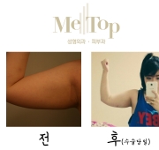 팔뚝초콜릿테…