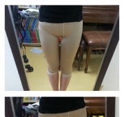 허벅지 지방흡…