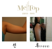 쵸콜렛 테라피 …