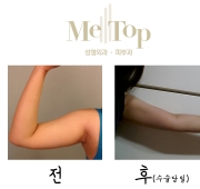 초콜렛테라피 …