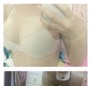 허벅지 지방흡…