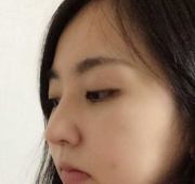 코수술(21일)