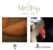 쵸콜렛테라피 …