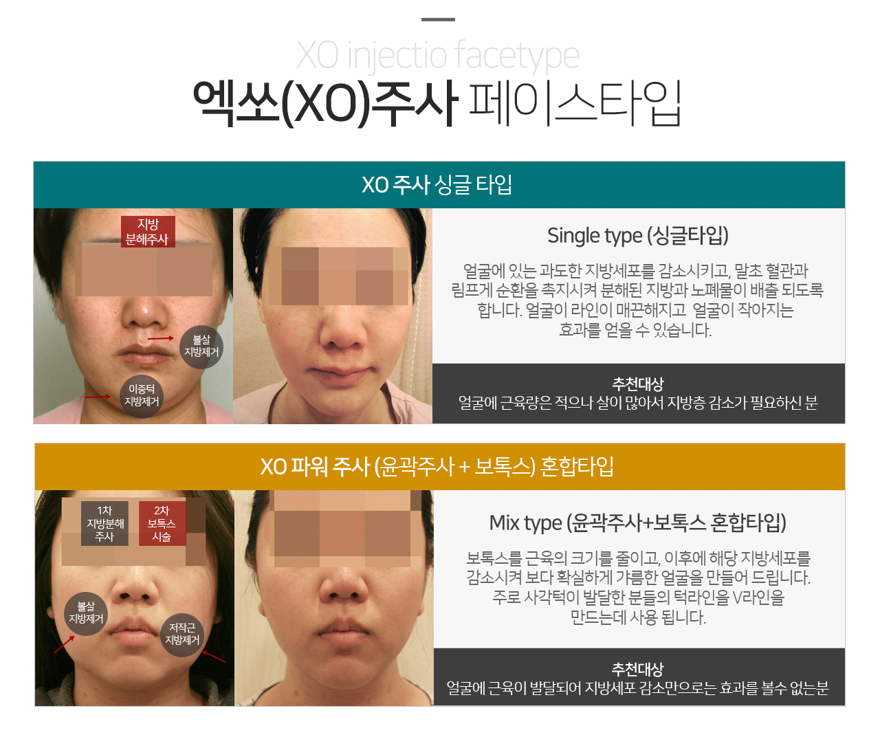 시술부위